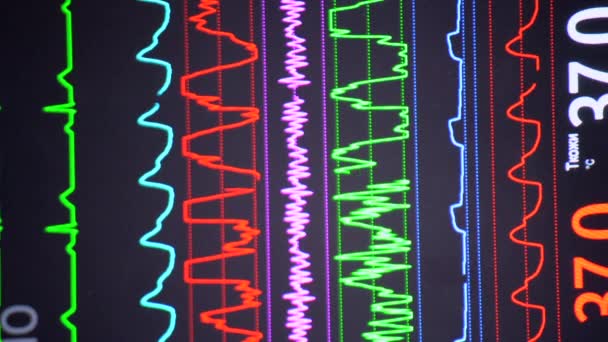 現代の患者モニター 医療指標を表示する電子健康モニターは 患者の重要な活動をグラフ表示します 医療上の重要な兆候 病院内のスクリーンコンピュータモニター 心臓図 Ecg Pulse垂直 — ストック動画