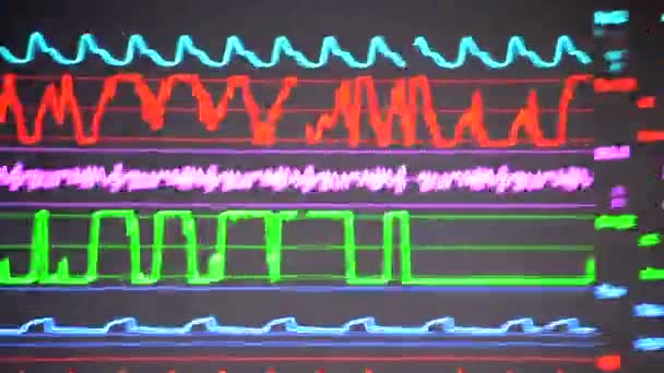 Modern Betegfigyelő Elektronikus Egészségügyi Monitor Orvosi Mutatókat Grafikonokat Mutat Beteg — Stock videók