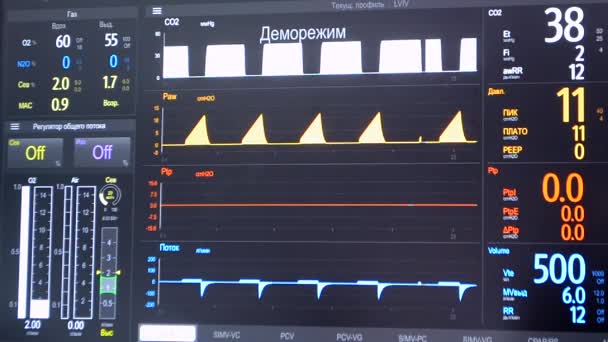 現代の患者モニター 電子健康モニターは 医療指標や患者の重要な活動のグラフを表示します 医療上の重要な兆候 病院内のコンピュータモニタの画面 心臓図 Ecg Pulse — ストック動画