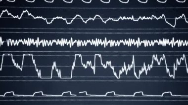 Modern hasta gözlemcisi. Elektronik Sağlık Monitörü, tıbbi göstergeler ve hastanın hayati aktivitelerinin grafiklerini gösteriyor. Hayati belirtileri var. Hastanede bilgisayar monitörü var. Kardiyogram ECG Nabzı