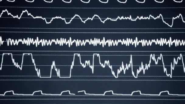 Moderno Monitor Paziente Monitoraggio Elettronico Della Salute Visualizzazione Indicatori Medici — Video Stock