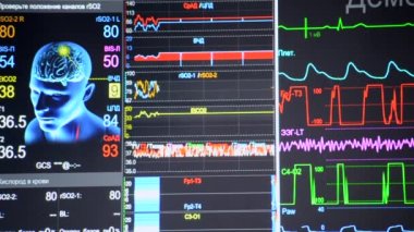 Hasta monitörü yakın çekim. Hastanelerdeki yaşam belirtileri farklı. Görüntü adamı, kafa, beyin, çizgiler, veri, göstergeler, bilgi. Modern tıp aletleri. Tıbbi monitör. ECG