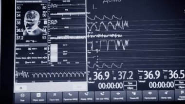 Hasta monitörü yakın çekim. Hastanelerdeki yaşam belirtileri farklı. Görüntü adamı, kafa, beyin, çizgiler, veri, göstergeler, bilgi. Modern tıp aletleri. Tıbbi monitör. ECG