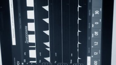 Hasta monitörü yakın çekim. Hastanelerdeki yaşam belirtileri farklı. Resim çizgileri, veriler, göstergeler, bilgiler. Modern tıp aletleri. Tıbbi monitör. EKG. Dikey