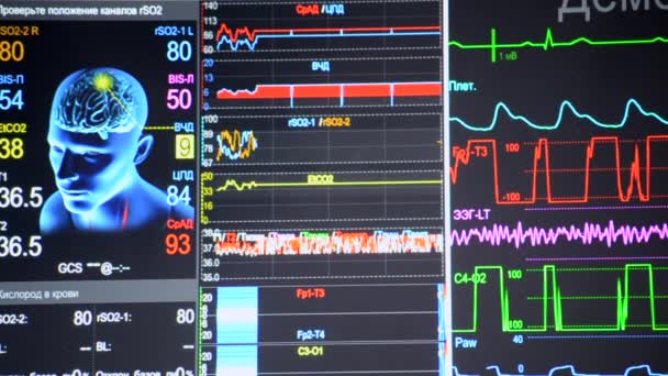 Zbliżenie Pacjenta Monitoruj Różne Oznaki Życiowe Pacjentów Szpitalach Wizerunek Głowa — Wideo stockowe
