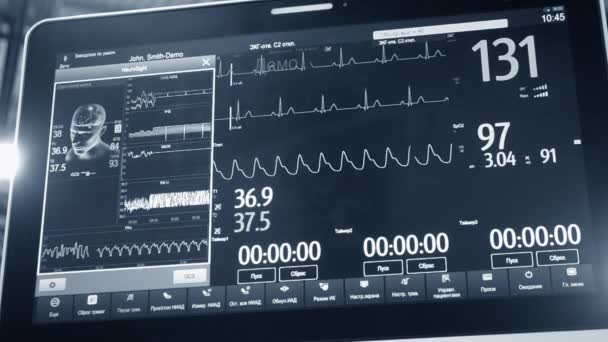 Sledování Pacienta Zblízka Monitor Různými Životními Funkcemi Pacientů Nemocnicích Obrazec — Stock video