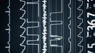 Modern hasta gözlemcisi. Elektronik Sağlık Monitörü, tıbbi göstergeler gösteriyor. Hastanın hayati aktivitelerini gösteriyor. Hayati belirtileri var. Hastanede bilgisayar monitörü var. Kardiyogram ECG Nabzı Dikey
