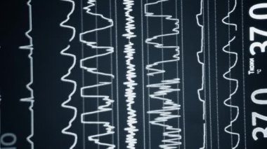 Modern hasta gözlemcisi. Elektronik Sağlık Monitörü, tıbbi göstergeler gösteriyor. Hastanın hayati aktivitelerini gösteriyor. Hayati belirtileri var. Hastanede bilgisayar monitörü var. Kardiyogram ECG Nabzı Dikey