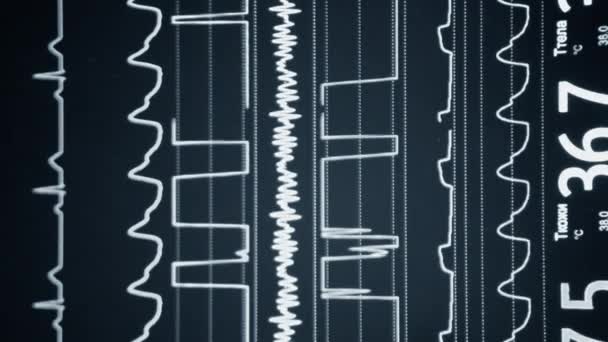 Moderne Patientenüberwachung Der Elektronische Gesundheitsmonitor Mit Medizinischen Indikatoren Zeigt Die — Stockvideo