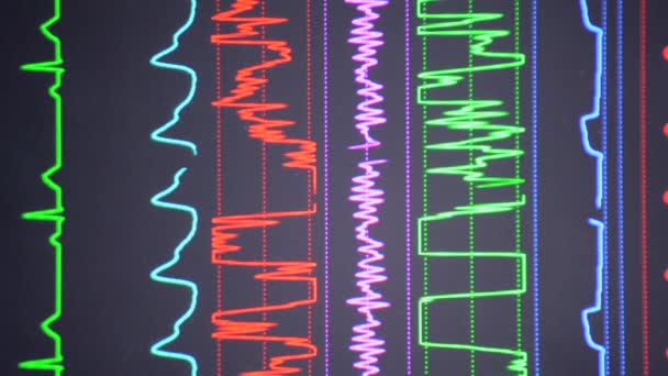 現代の患者モニター 医療指標を表示する電子健康モニターは 患者の重要な活動をグラフ表示します 医療上の重要な兆候 病院内のスクリーンコンピュータモニター 心臓図 Ecg Pulse垂直 — ストック動画