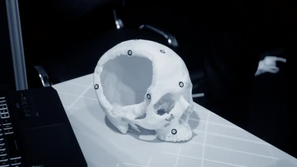 3Dスキャナを搭載した男3Dスキャンプロトタイプ人間の頭蓋骨白いプラスチックから3Dプリンタで印刷されました レーザースキャニングオブジェクト オブジェクトをキャプチャするための3Dスキャナ コンセプト ハイテク機器 — ストック動画