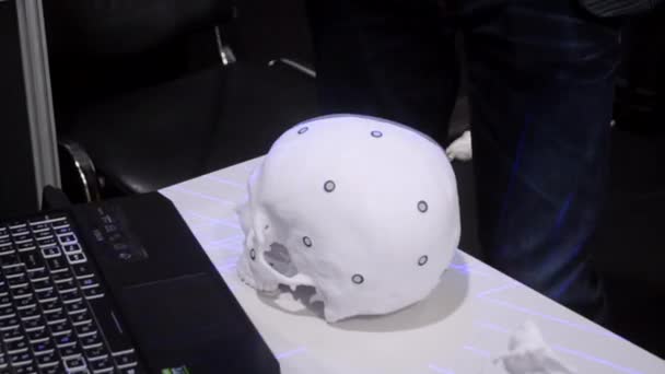 3Dスキャナを搭載した男3Dスキャンプロトタイプ人間の頭蓋骨白いプラスチックから3Dプリンタで印刷されました レーザースキャニングオブジェクト オブジェクトをキャプチャするための3Dスキャナ コンセプト ハイテク機器 — ストック動画