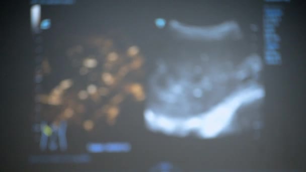 Wazige Achtergrond Echografie Monitor Ultrasone Scan Weergave Screening Ultrasonografie Analyse — Stockvideo