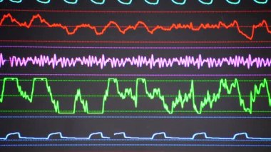Modern hasta gözlemcisi. Elektronik Sağlık Monitörü, tıbbi göstergeler ve hastanın hayati aktivitelerinin grafiklerini gösteriyor. Hayati belirtileri var. Hastanede bilgisayar monitörü var. Kardiyogram ECG Nabzı
