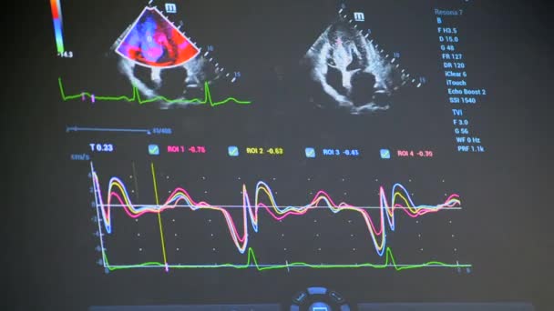 Moderne Patientenüberwachung Der Elektronische Gesundheitsmonitor Zeigt Medizinische Indikatoren Und Diagramme — Stockvideo