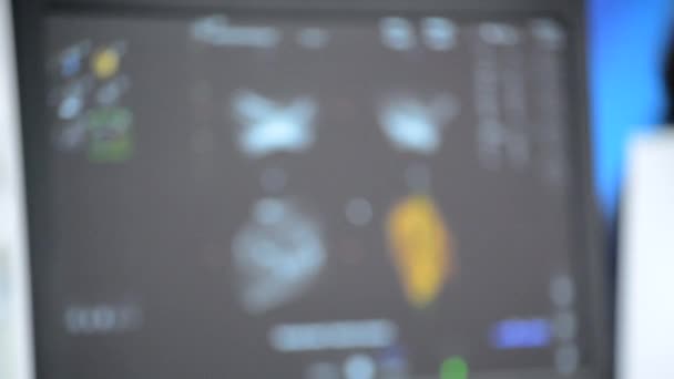 模糊的背景 监视器上的Utrasound图像 超声波扫描显示 对人进行超声扫描分析 用扫描仪进行超声波检查 超声波扫描装置 超声心动图 — 图库视频影像