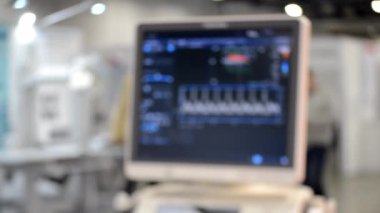 Arka plan bulanık. Ultrason görüntüsü ekranda. Ultrason görüntüsü. Kişinin Ultrasonografi Analizi Taraması. Tarayıcı kullanarak ultrason muayenesi. Ultrason Tarama Cihazı. Ekokardiyografi