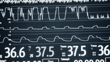 Modern hasta gözlemcisi. Elektronik Sağlık Monitörü, tıbbi göstergeler ve hastanın hayati aktivitelerinin grafiklerini gösteriyor. Hayati belirtileri var. Hastanede bilgisayar monitörü var. Kardiyogram ECG Nabzı