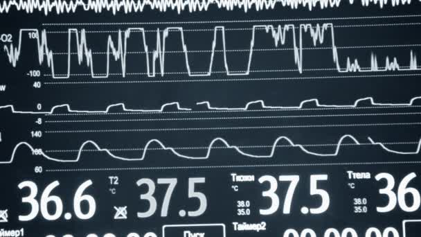 Moderne Patientenüberwachung Der Elektronische Gesundheitsmonitor Zeigt Medizinische Indikatoren Und Diagramme — Stockvideo