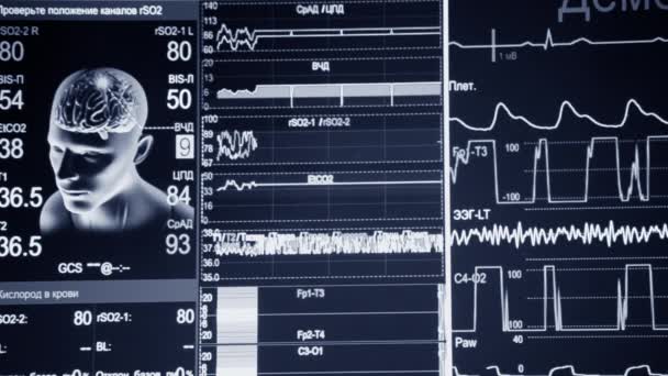 Hasta Monitörü Yakın Çekim Hastanelerdeki Yaşam Belirtileri Farklı Ekg Tıbbi — Stok video