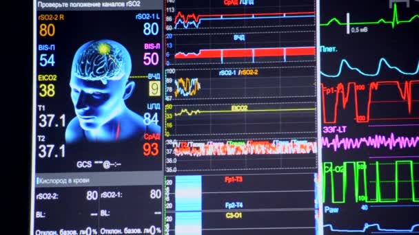 Patientenüberwachung Aus Nächster Nähe Monitor Mit Unterschiedlichen Patienten Vitalzeichen Krankenhäusern — Stockvideo
