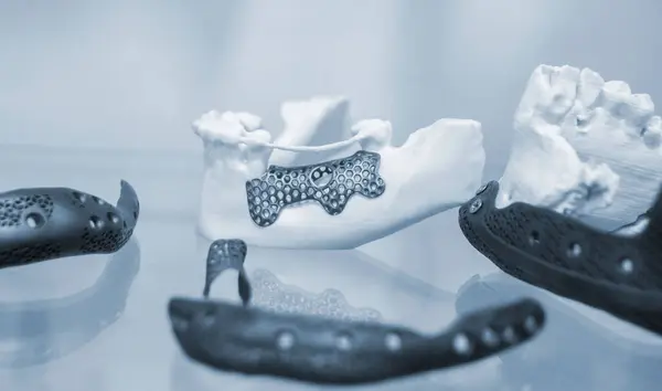 金属粉末から3Dプリンターに印刷された下部ヒト顎個体の顔面骨 粉末3Dプリンターによって作成された顎骨の医療チタンプロトタイプ エンドプロステーシスのインプラント ロイヤリティフリーのストック画像