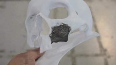 Elinde beyaz plastikten yapılmış bir insan kafatasının prototipini tutan bir insan. Üç boyutlu bir yazıcıya biyo-uyumlu titanyumdan yapılmış bir implant. Biyomühendislik, hastaya özgü kesik yüz protezi..