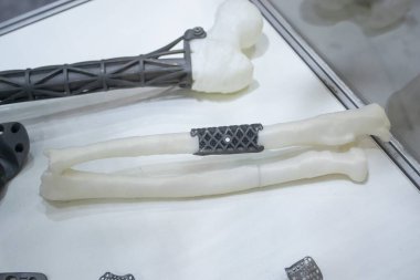 Biyolojik uyumlu titanyum tozundan üç boyutlu yazıcıya implantlar ve protezler basılmış. Titanyum protezi, üç boyutlu yazıcıya basılmış beyaz insan kemiğine boru kemikleri yerleştirildi. Biyomühendislik Endoprotezi