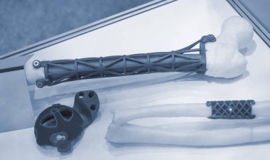 Biyolojik uyumlu titanyum tozundan üç boyutlu yazıcıya implantlar ve protezler basılmış. Üç boyutlu yazıcıya basılmış beyaz insan kemiğine boru kemiği nakli. Kalça eklemi nakli. Endoprotezler
