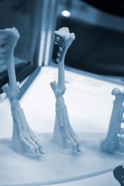 Biyolojik uyumlu titanyum tozundan üç boyutlu yazıcıya implantlar ve protezler basılmış. Hayvanların deformasyonunu düzeltmek için tabaklar. Plastikten 3 boyutlu yazıcıya basılmış hayvan kemikleri üzerindeki Titanyum plakalar.
