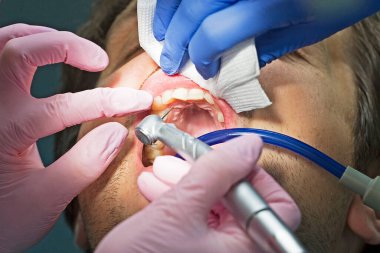 Diş hekimi hastaya ön diş tedavisi uygular.