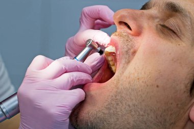 Diş hekimi hastaya ön diş tedavisi uygular.