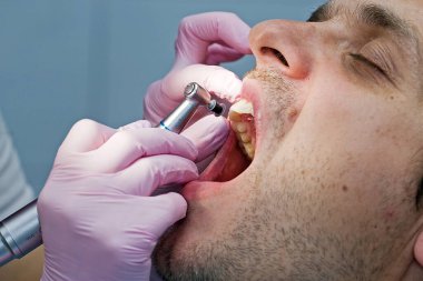 Diş hekimi hastaya ön diş tedavisi uygular.