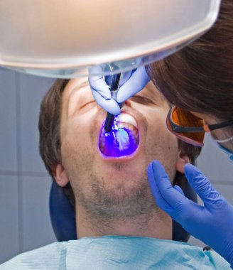 Dantis lazer diş ağrısıyla parlıyor.