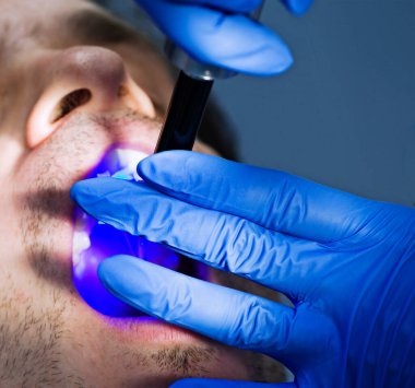 Dantis lazer diş ağrısıyla parlıyor.