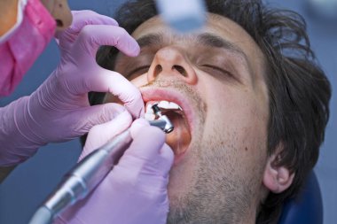 Diş hekimi hastaya ön diş tedavisi uygular.