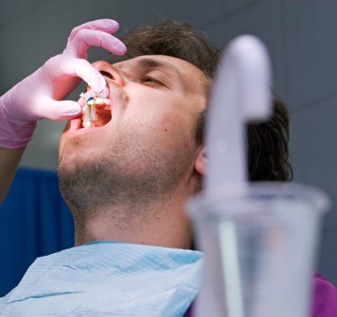 Dişçi hastanın ön dişlerini gıcırdatır.