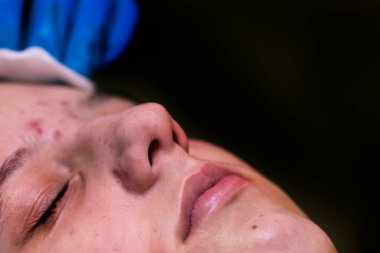 Bir güzellik uzmanına gidip yüzünü temizleyen mutlu bir genç kızın fotoğrafı. Güzellik uzmanı yüzünü özel mendillerle siliyor.