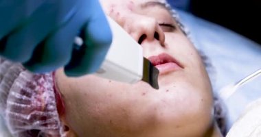 Güzellik uzmanı lazer ve fırçayla temizlik yapar. Genç bir kızın nazik bebek çenesi, yatay.