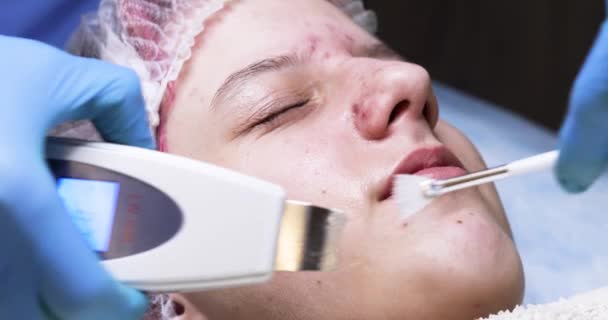 Kosmetoloog Reinigt Met Een Laser Een Kwast Het Tedere Kinderachtige — Stockvideo