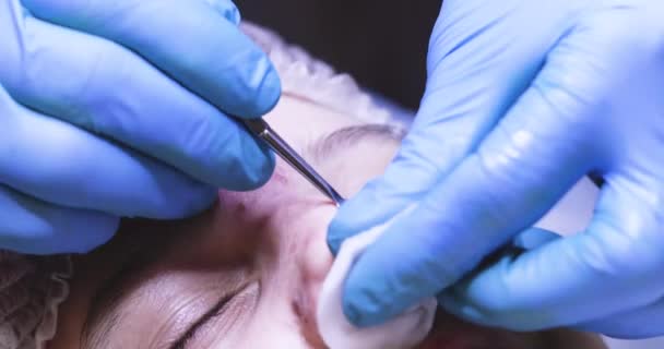 Kosmetolog Odstraňuje Černé Tečky Nosu Speciálním Nástrojem Dospívání Horizontální — Stock video