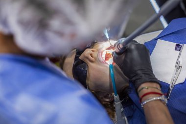 Dişçi randevusunda ağzı açık bir kız. Ortodontist tedavisi ve diş bakımı