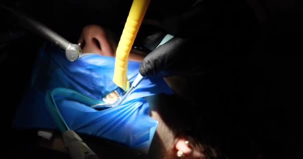 牙医用机器的涡轮机尖在生病的牙齿上打了一个洞 然后才把它填满 牙齿的护理和健康 — 图库视频影像