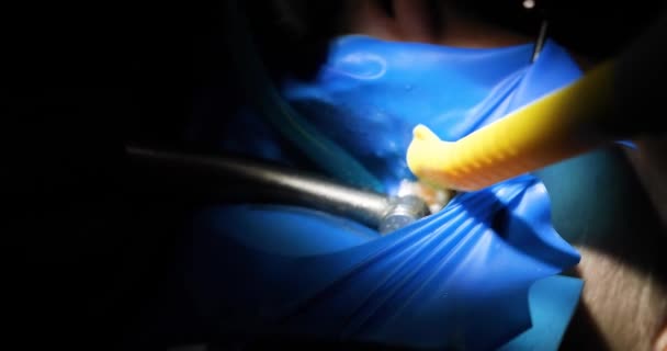 Stomatolog Asystent Rękawiczkach Leczą Chorego Zęba Opieka Zdrowie Zębów — Wideo stockowe
