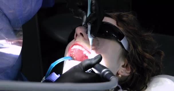 歯科医は ドリルマシンのタービンチップを使用して それを満たす前に 病気の歯に穴を作ります 歯のケアと健康について — ストック動画