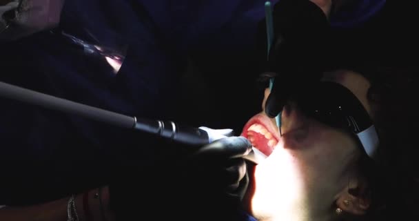 歯科医は ドリルマシンのタービンチップを使用して それを満たす前に 病気の歯に穴を作ります 歯のケアと健康について — ストック動画