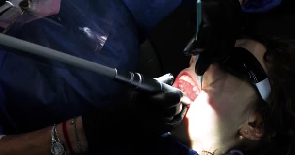 歯科医はタービンチップを使用して それを満たす前に 病気の歯に穴を作ります 歯のケアと健康について — ストック動画
