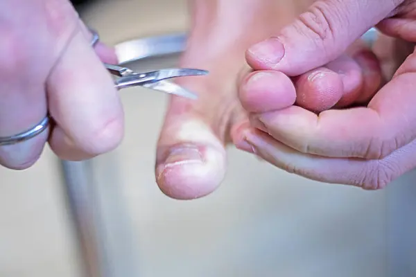 cut the nails from the index finger of the left foot with manicure scissors at home. Foot and nail care