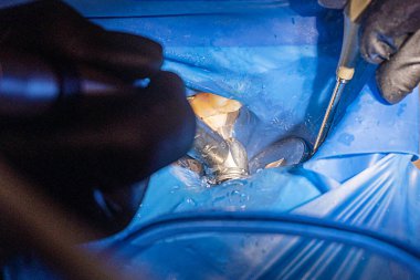 Dişçi, hastaların dişlerini ayna ile onarmak için özel bir alet kullanır.. 