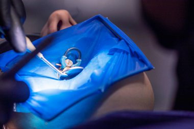 Dişçi, hastaların dişlerini ayna ile onarmak için özel bir alet kullanır.. 